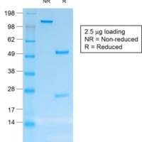 CD30 / TNFRSF8 (Hodgkin & Reed-Sternberg Cell Marker) (rCD30/412), CF488A conjugate, 0.1mg/mL