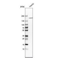 Anti-A2M Antibody