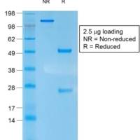 Cytokeratin 10 (Suprabasal Epithelial Marker) (rKRT10/1275), CF488A conjugate, 0.1mg/mL