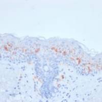 CD1a / HTA1 (Mature Langerhans Cells Marker) (rC1A/711), CF488A conjugate, 0.1mg/mL
