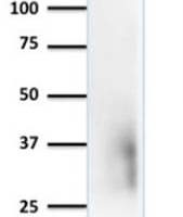 Beta-2 Microglobulin (Renal Failure &Tumor Marker) (rB2M/961), CF405S conjugate, 0.1mg/mL