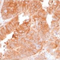 Beta-2 Microglobulin (Renal Failure &Tumor Marker) (rB2M/961), CF405S conjugate, 0.1mg/mL