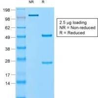 Chromogranin A / CHGA (Neuroendocrine Marker) (rCHGA/798), CF405S conjugate, 0.1mg/mL