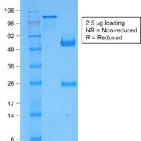 Beta-2 Microglobulin (Renal Failure & Tumor Marker) (B2M/1857R), CF405S conjugate, 0.1mg/mL