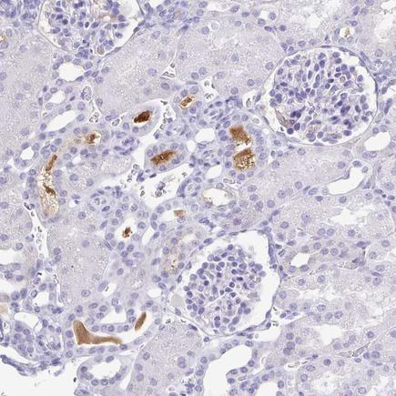 HPA044252
