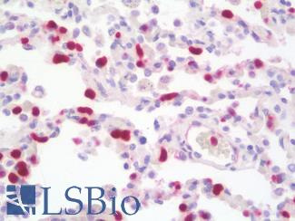 LS-B9966-50